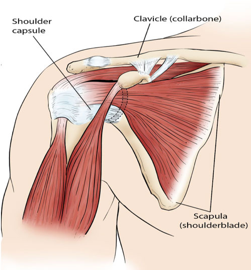 Is a TENS Machine Good for Frozen Shoulder?