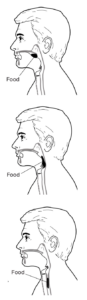 Dysphagia Diagram Ohio State University