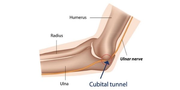 Cubital Tunnel Therapy in Boerne, Texas