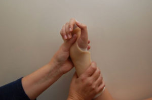 Carpal Tunnel Syndrome CHT